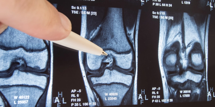 image of orthopaedics