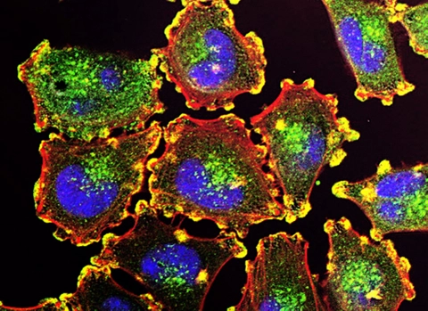 Scientists pinpoint new vaccine &ldquo;booster&rdquo; that promotes potent anti-tumour immunity
