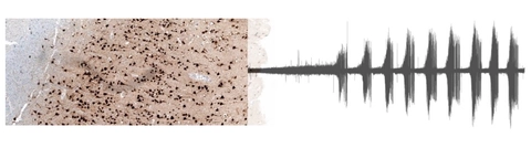 &ldquo;Live&rdquo; human brain biosamples to revolutionise translational neuroscience research