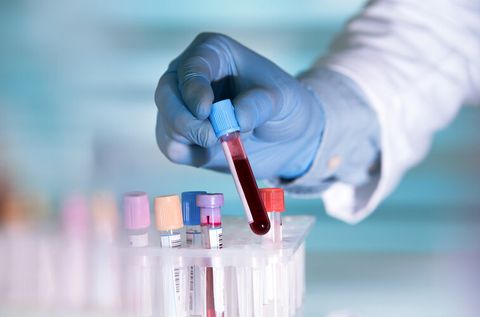 Research offers insight into the future understanding of MS and its treatments