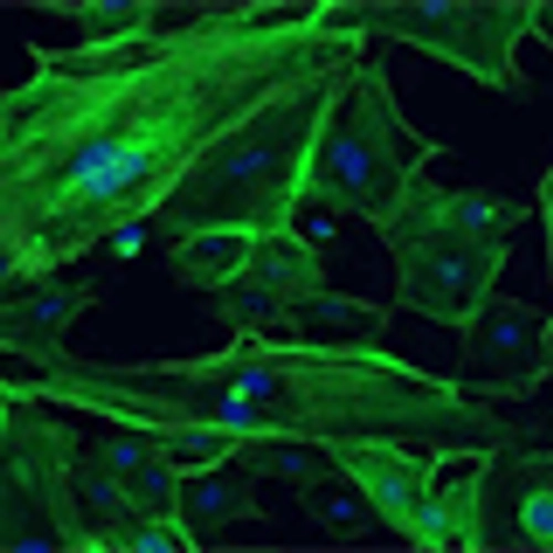 Translational Immunology