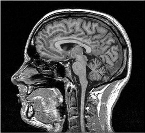 Scanned brain imagery