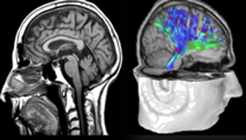 research - brain nerves