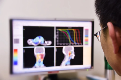 Radiation Therapy scan appearing on the screen of a computer