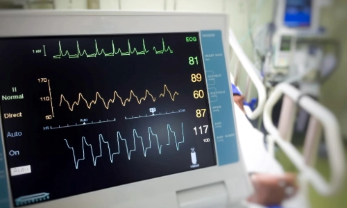 A blood pressure monitor