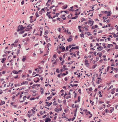 translational cancer diagram