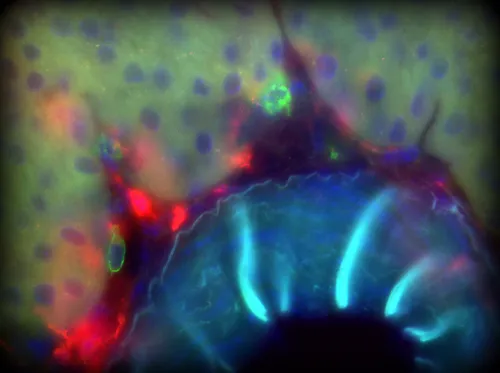 Trinity Health Kidney Centre