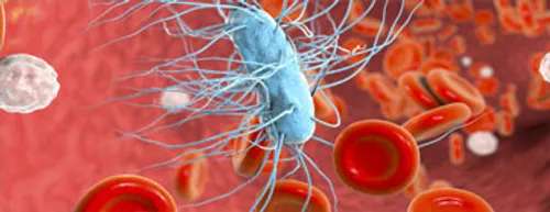 Translational Immunology, Inflammation and Infection