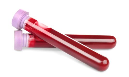 Two blood collection tubes containing biood