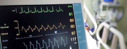 A blood pressure monitor