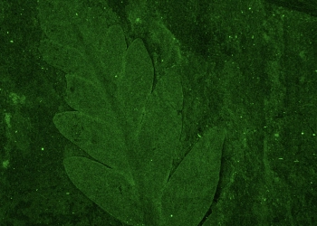 Image of leaf cells under a microscope