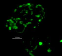 Eukaryotic Gene Regulation
