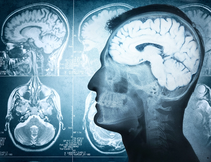 Medical Imaging