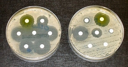 Antimicrobial Resistance and Host Modulation image