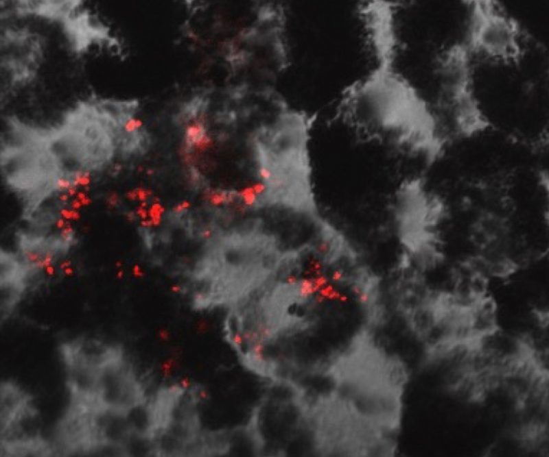 The honeycomb structure of human retinal pigment epithelial (RPE) cells with oxidative stress induced complement (C5b-C9) in red.