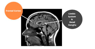 Brain structures, ADHD