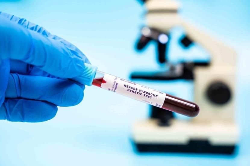 A picture of a test tube containing blood with the text 'Weaver syndrome genetic test' on the outside of the tube